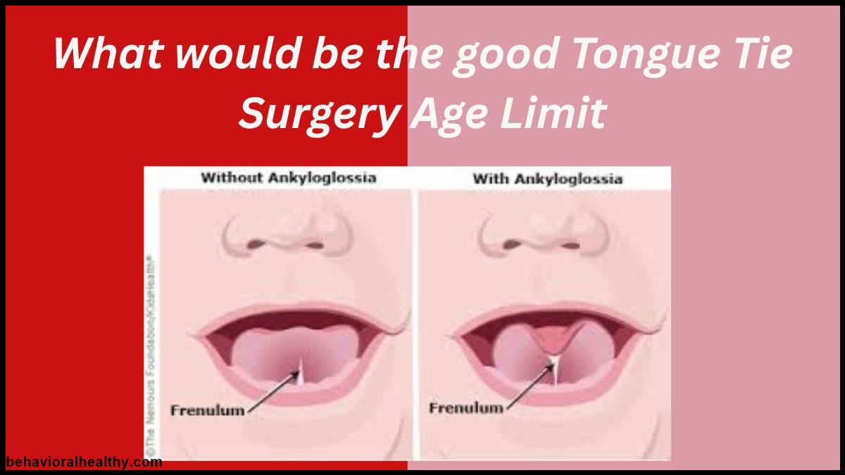 What would be the good Tongue Tie Surgery Age Limit.jpg